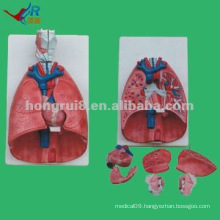 Anatomical Parts of Lungs,Heart lung and larynx Model,Training Lung Model